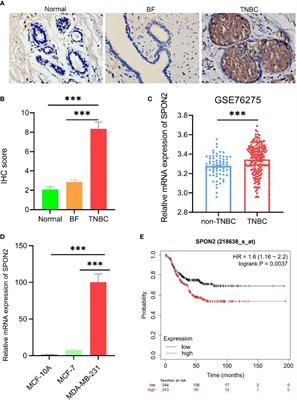 Frontiers Knockdown Of SPON2 Inhibits The Growth Of Triple Negative